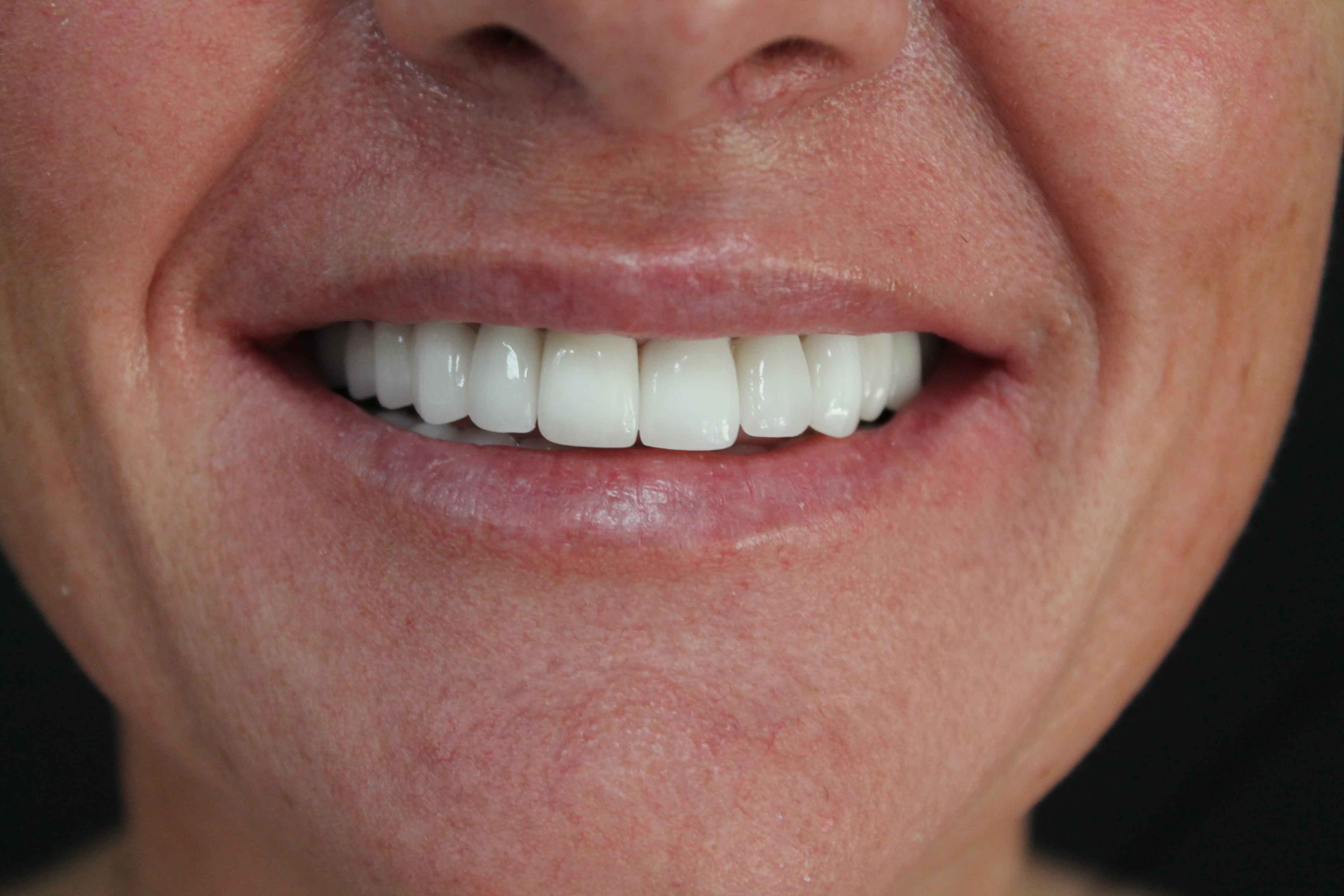 Alison-After-min Alison After