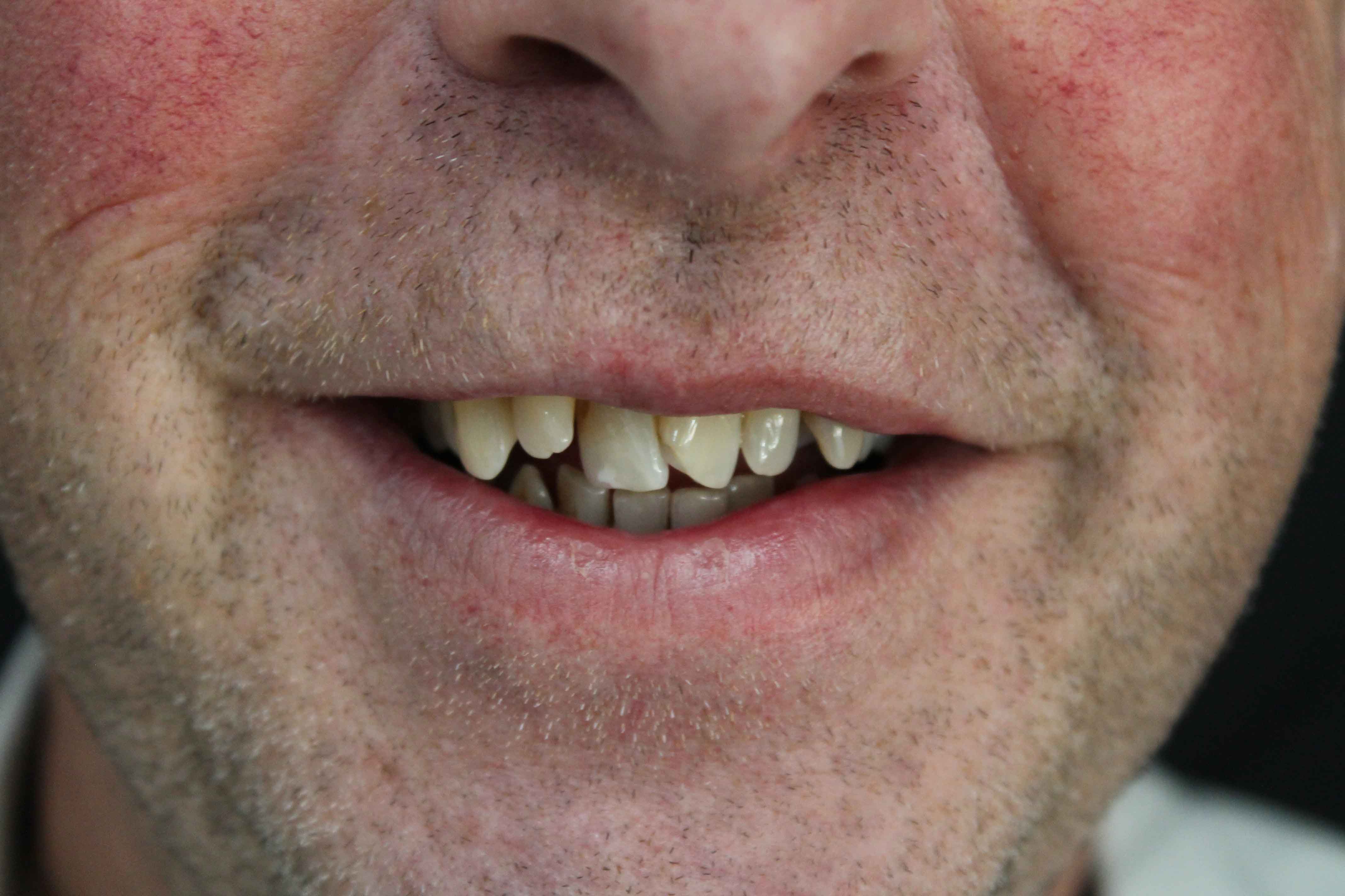 Colin-Before-min Colin Before