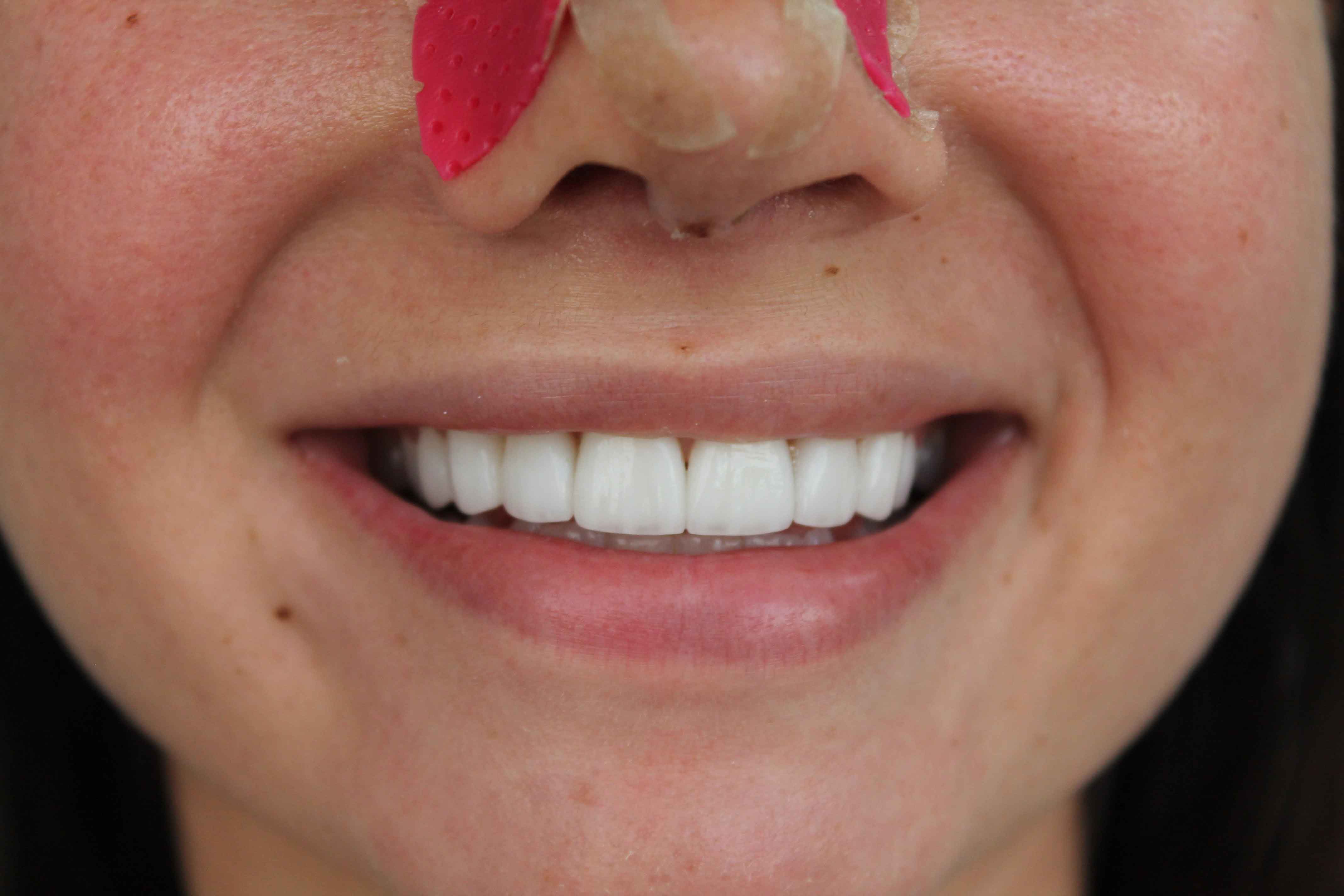 Danijela-After-min Danijela After