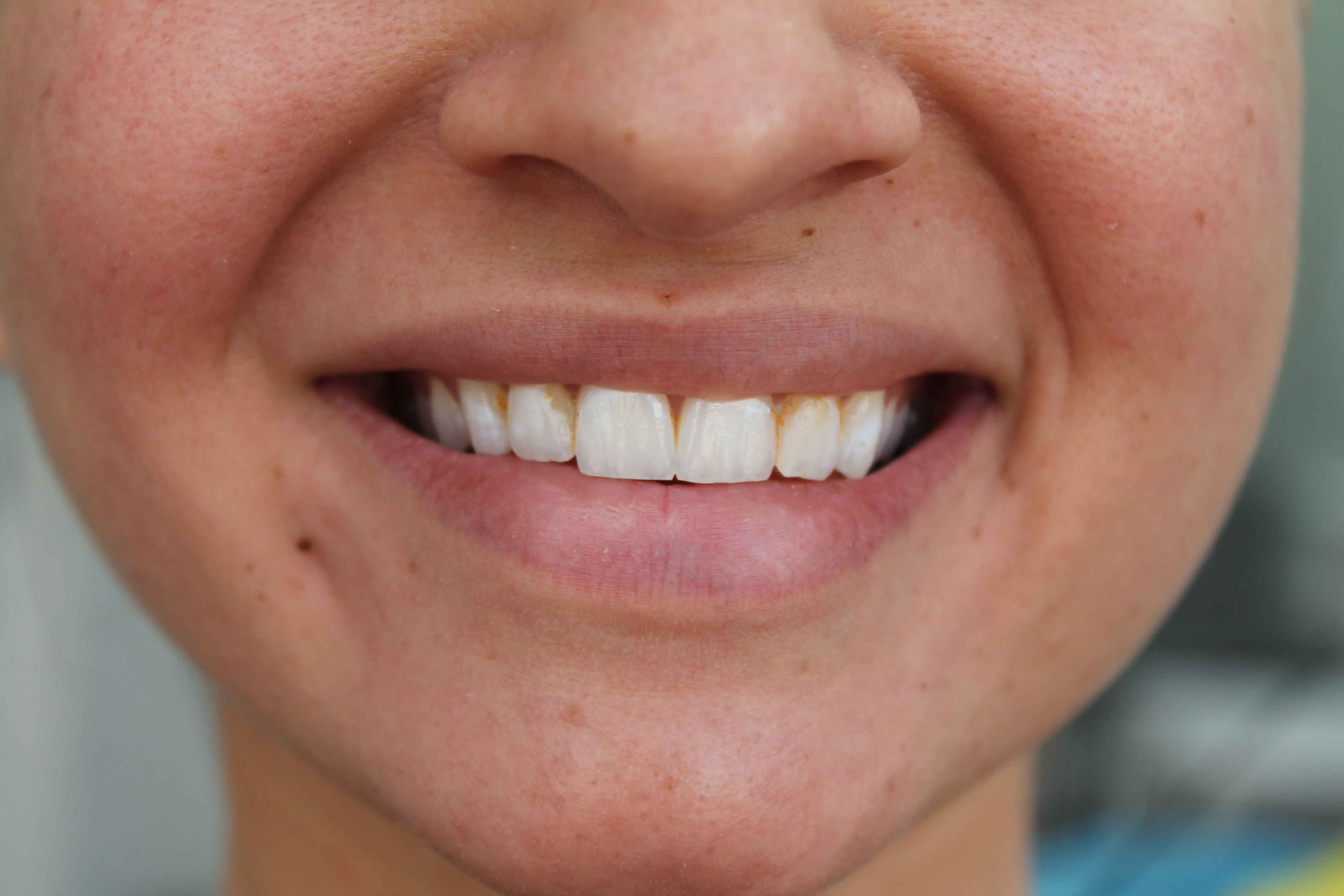 Danijela-Before-min Danijela Before