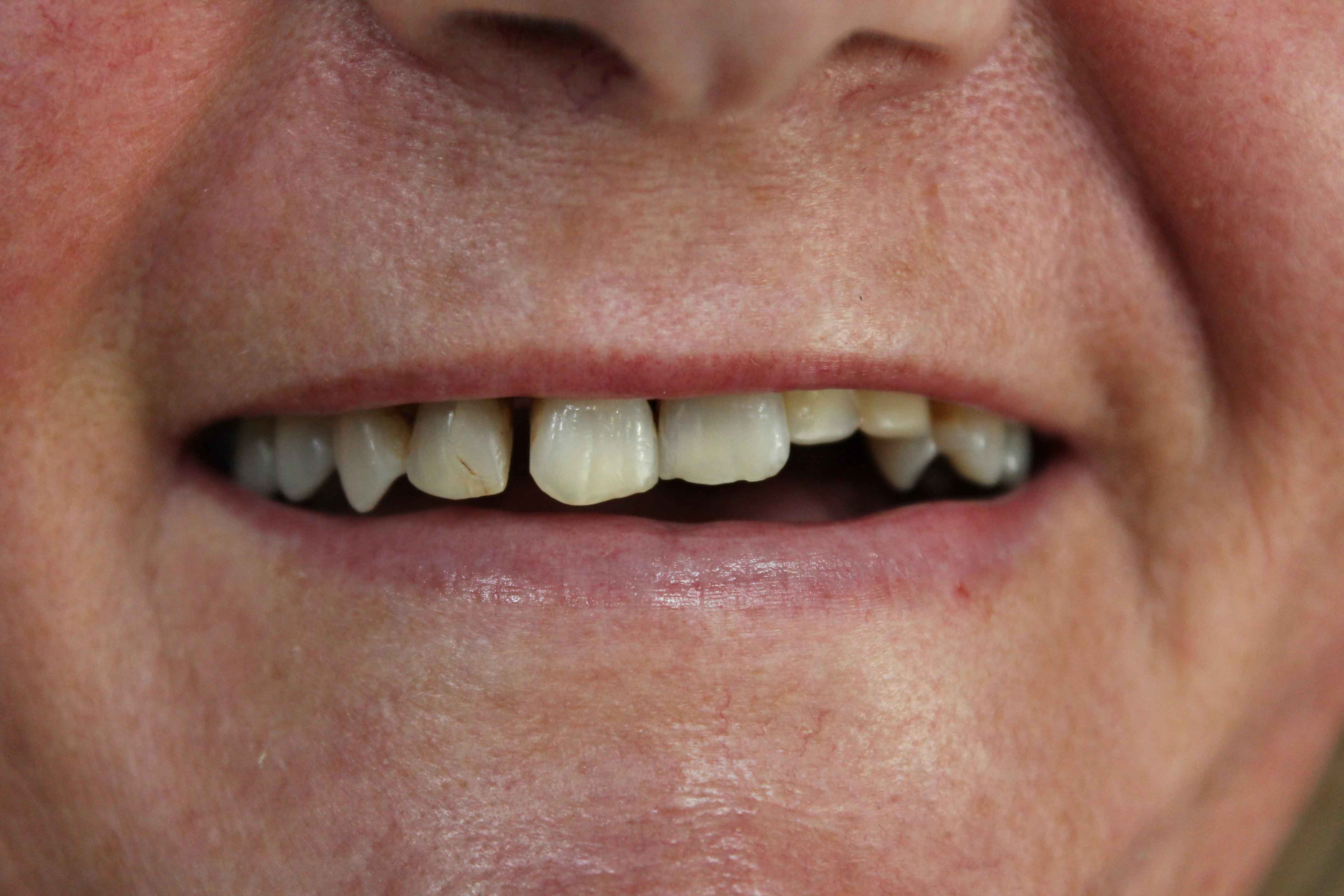 Deborah-Before-min Deborah Before