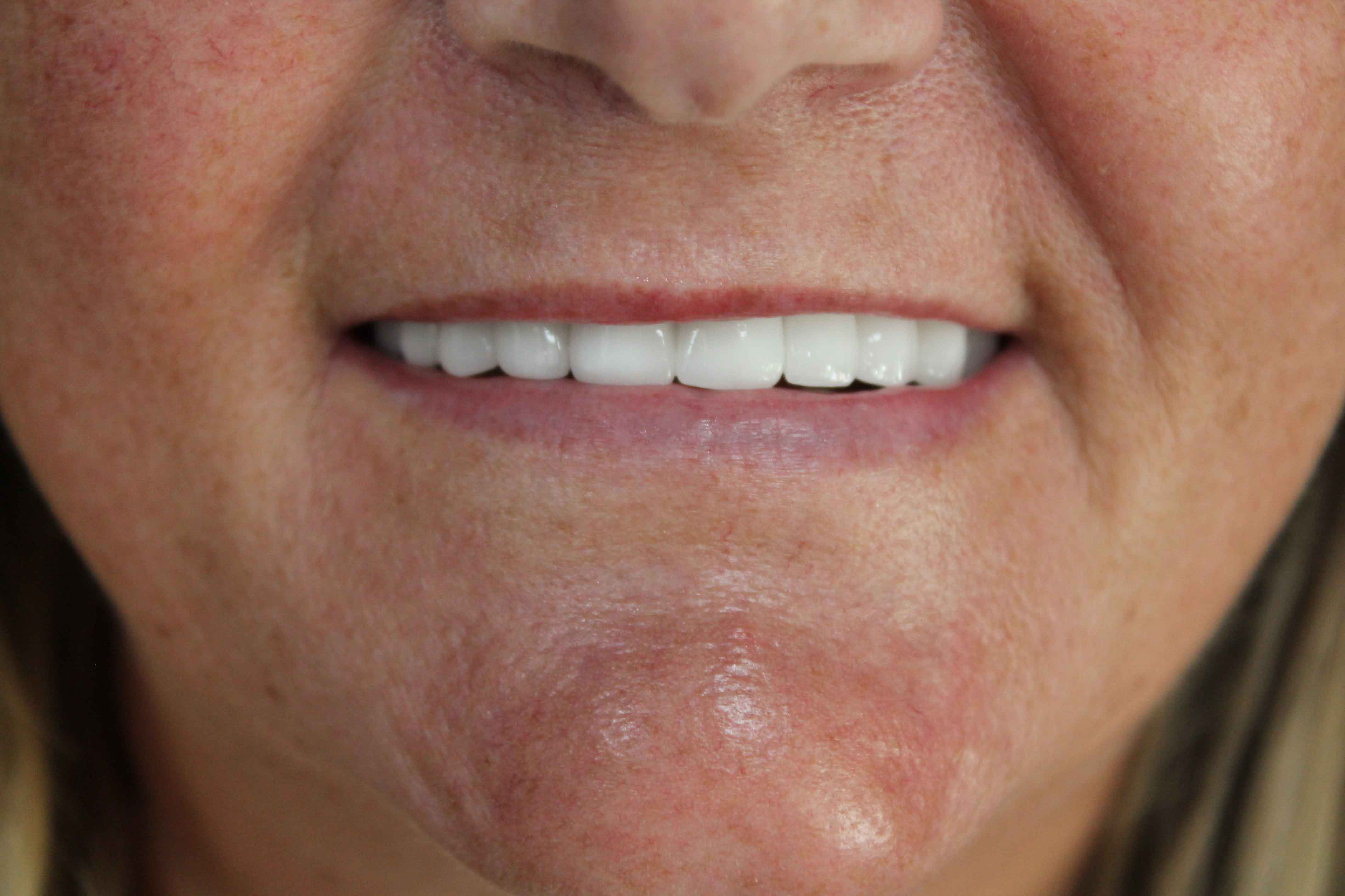 Deborah-min Deborah After