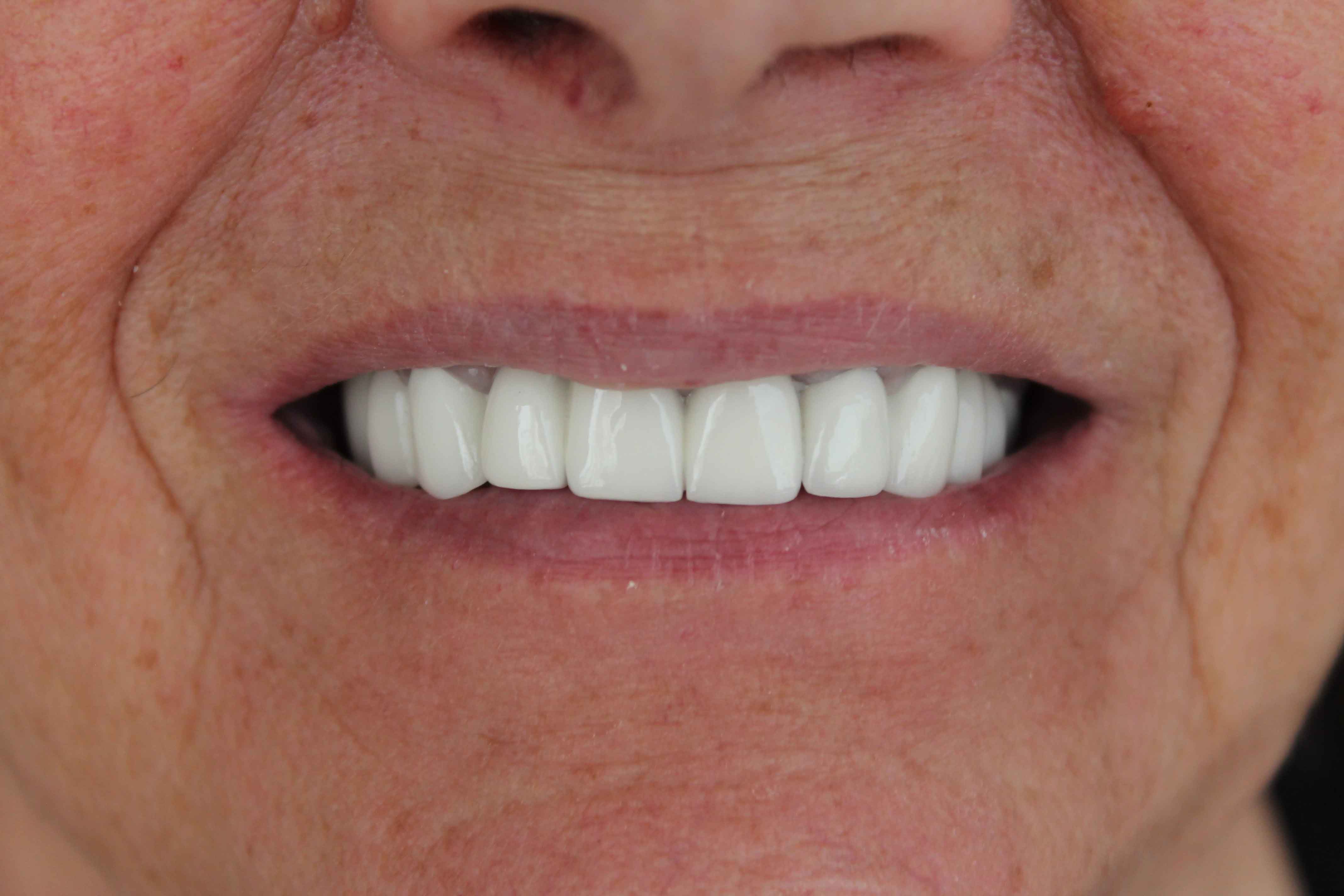 Linda-after-min Linda after