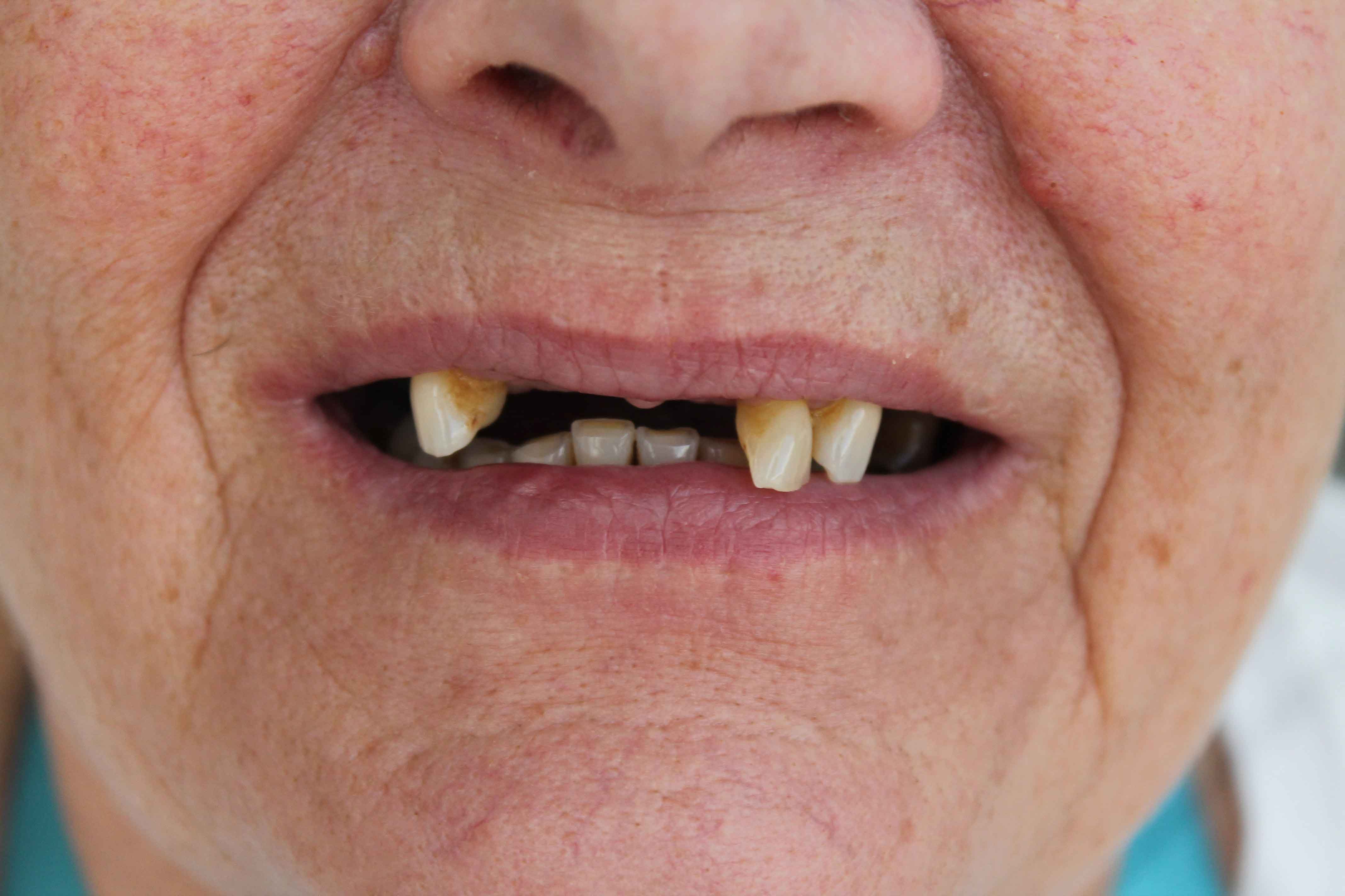 Linda-before-min Linda before