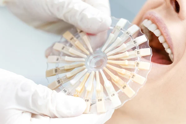 What is Dental Veneers in Turkey?