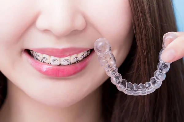 orthodontic treatment